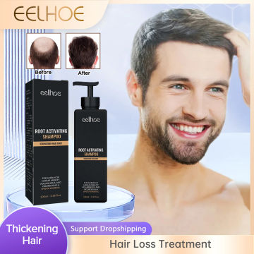 Hair Loss Treatment Shampoo Promote Growth Strengthen Hair Roots Scalp Repair Anti Thinning Moisturizing Thickening Hair Care