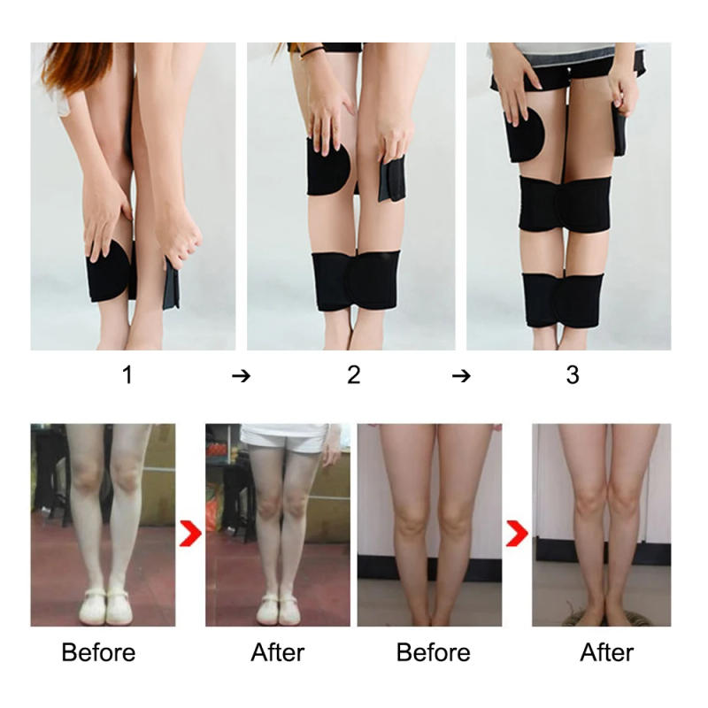 Description Picture 4 of item3Pcs/Set O/X Type Leg Correction Band Belt Bowed Legs Knee Valgum Straightening Posture Corrector Beauty Leg Band