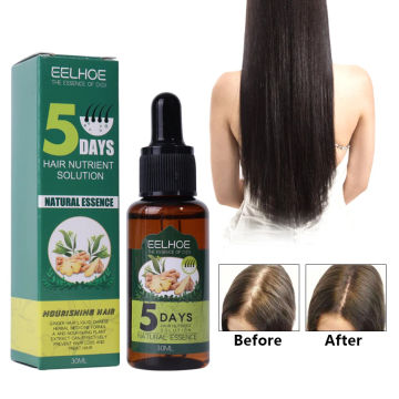 1PC Anti Hair Loss Essential Oil Care Essence Anti Hair Loss Rapid Growth Ginger Hair Care Essential Oil Hair Growth Liquid