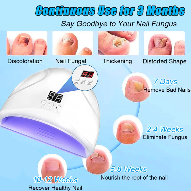 Description Picture 4 of itemNail Fungus Laser Treatment Device Repair Removes Toenail Fingernail Treatment Onychomycosis with Mushrooms Foot Care Tool
