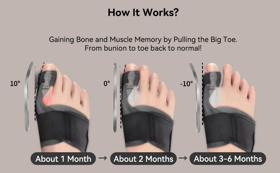 Description Picture 3 of itemTech Love Hallux Valgus Corrector Toe Straightener Best for Toe Alignment and Bunion Pain Relief Foot Care Tools