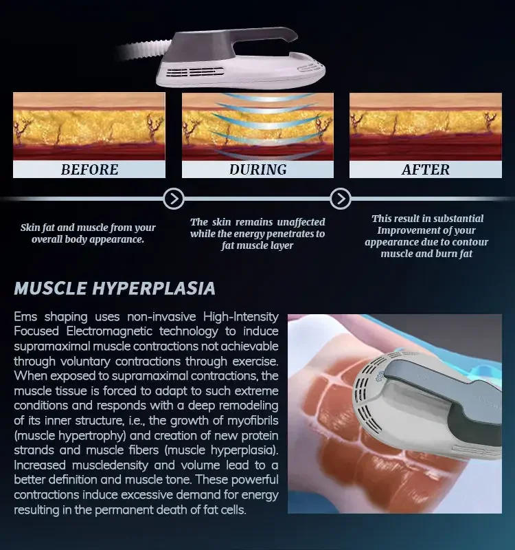 Description Picture 3 of itemWeight lose Portable Electromagnetic Body   Slimming Muscle Stimulate Fat Removal Body Slimming build muscle Machine