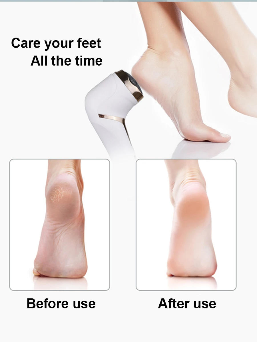 Description Picture 5 of itemElectric Foot File Pedicure Machine Callus Remover Rechargeable Foot Heel Cracked Dead Skin Scrubber Polisher Grinder Tools