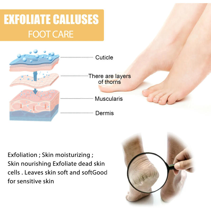 Description Picture 4 of itemOuhoe Foot Exfoliating Spray 72H Moisture Lock Callus Softener Anti Dry Crack Repair Odor Control Brightening Foot Care Liquid