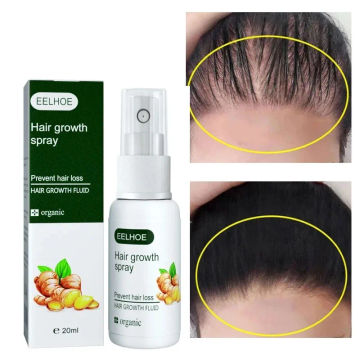 Ginger Anti Hair Loss Serum Fast Hair Growth Oil Hair Treatment Sprays Nourish Scalp Regrowth Hairs Thinning Dry Repair Care