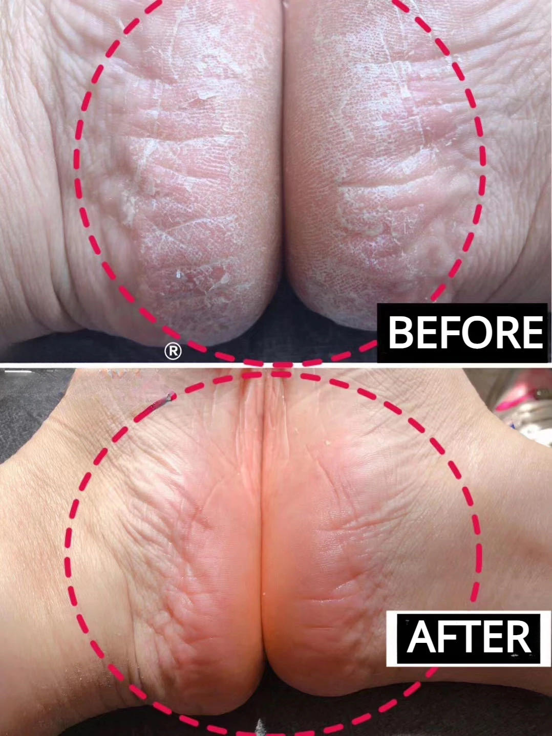 Description Picture 6 of itemSilicone Heel Protector Feet Care Skin Repair Cushion Half-yard Socks for Women Men Heel Cover Relief Heel Pain Reduce Pressure