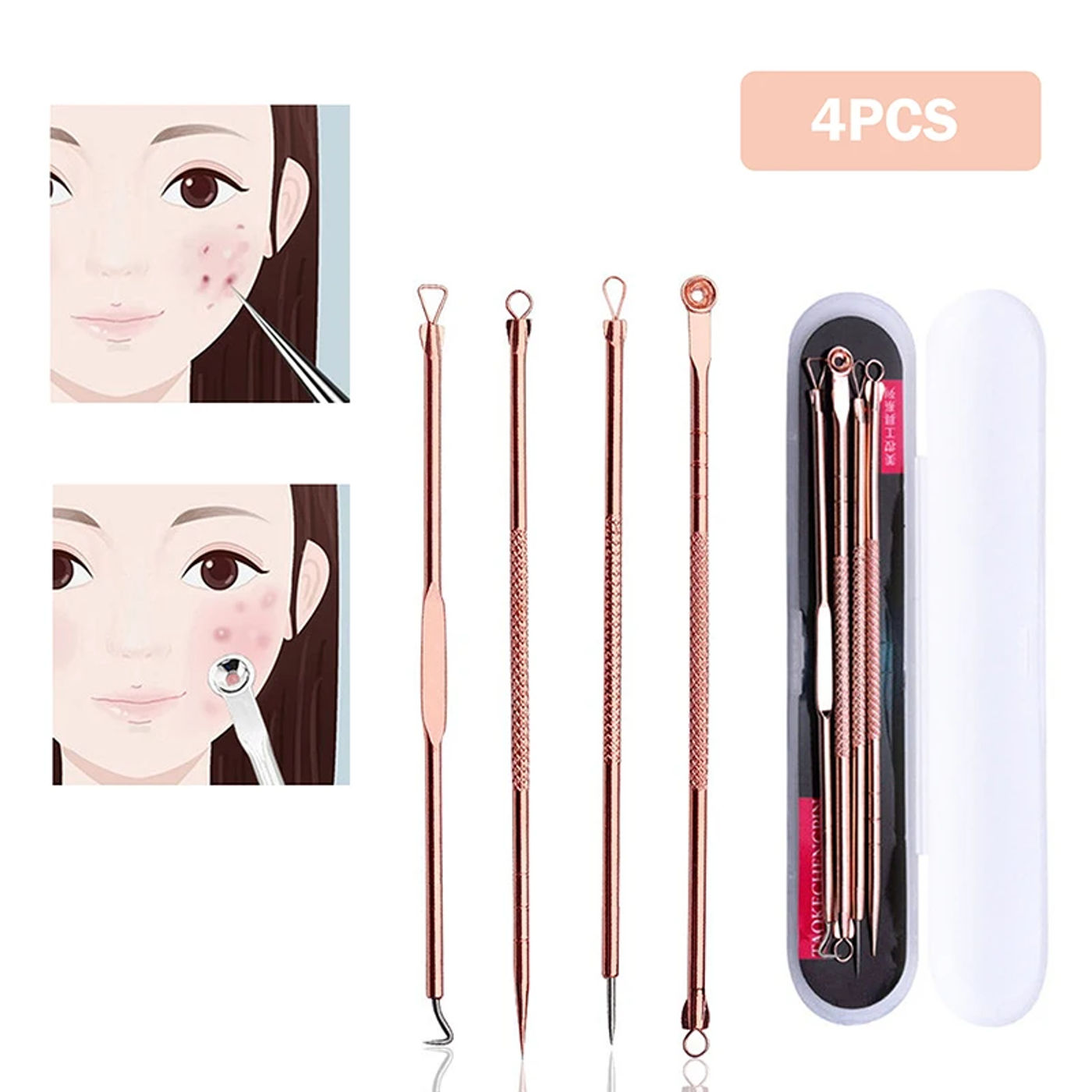 Description Picture 2 of item4Pcs Acne Extractor Remover Tool Kit Blackhead Blemish Removers Pimple Needles