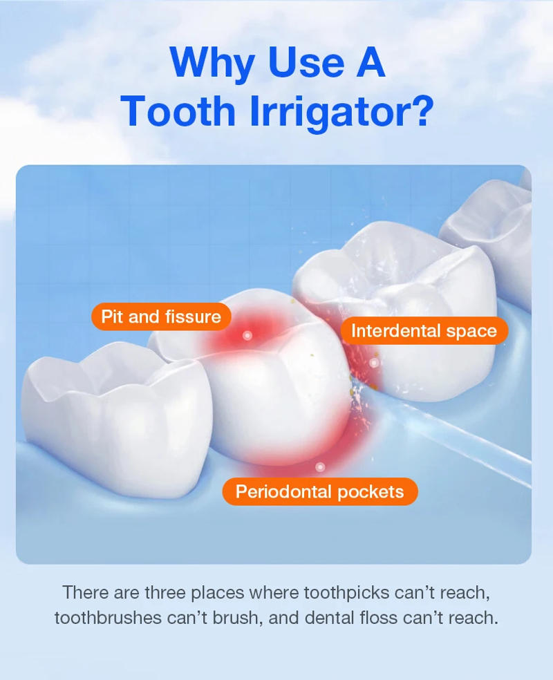 Description Picture 5 of itemAiruidu Portable Smart Electric Oral Irrigator Water Flosser Deodorizes Breath Freshens Breath Prevents Bad Germs 4 Mode Nozzles