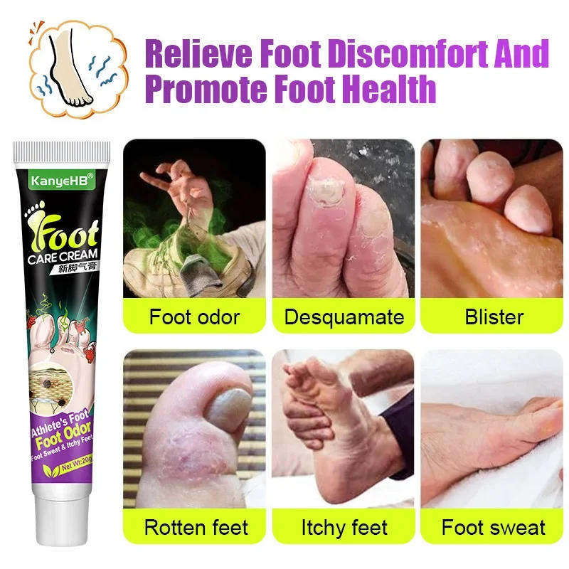 Description Picture 2 of item네일 Foot Care Tools KanyeHB Foot Ointment Feet Odor Care Cream Feet Skin Topical Cream Masajeador De Pies علاج الاسترخاء