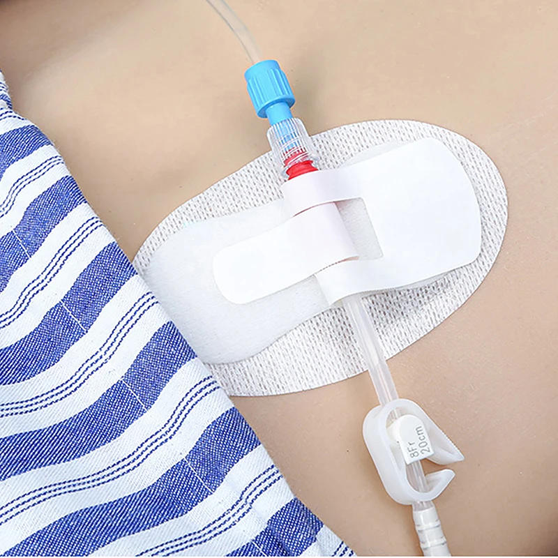 Description Picture 4 of itemCatheter Holder Tube Sticker Bag Strap Urinary Leg Legband Adhesive Urine Fixing Band Device Anchor G Stabilization Nephrostomy