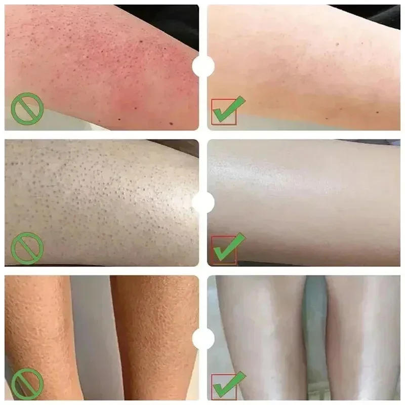 Description Picture 4 of item60% Urea Foot Cream Dry Cracked Feet Heel Gentle Exfoliation Softening Skin Ultra-Hydrating Hand Foot Care Cream Stick Protucts