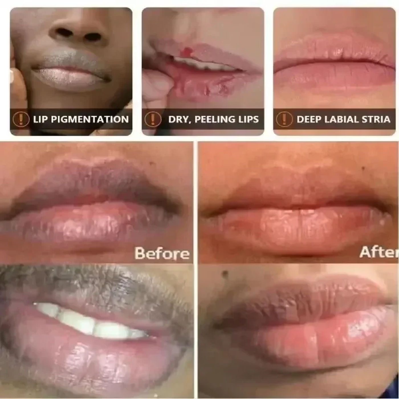Description Picture 2 of itemRemove Dark Lip Balm Lightening Melanin Mask Gloss Exfoliating Lip Pink Treatment Reduce Lip Lines Improve Dryness Moisturizing