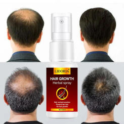 Ginger Hair Growth Essence Oil Spray Fast Growing Serum Anti Hair Loss Products Prevent Hair Thinning Frizzy Damaged Hair Care