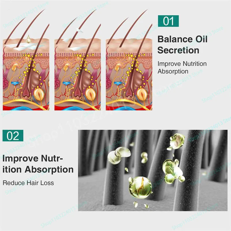 Description Picture 6 of itemhair growth treatment Oil fast hair growth products  Anti Hair Loss Hair Scalp Treatment Serum Beauty Health