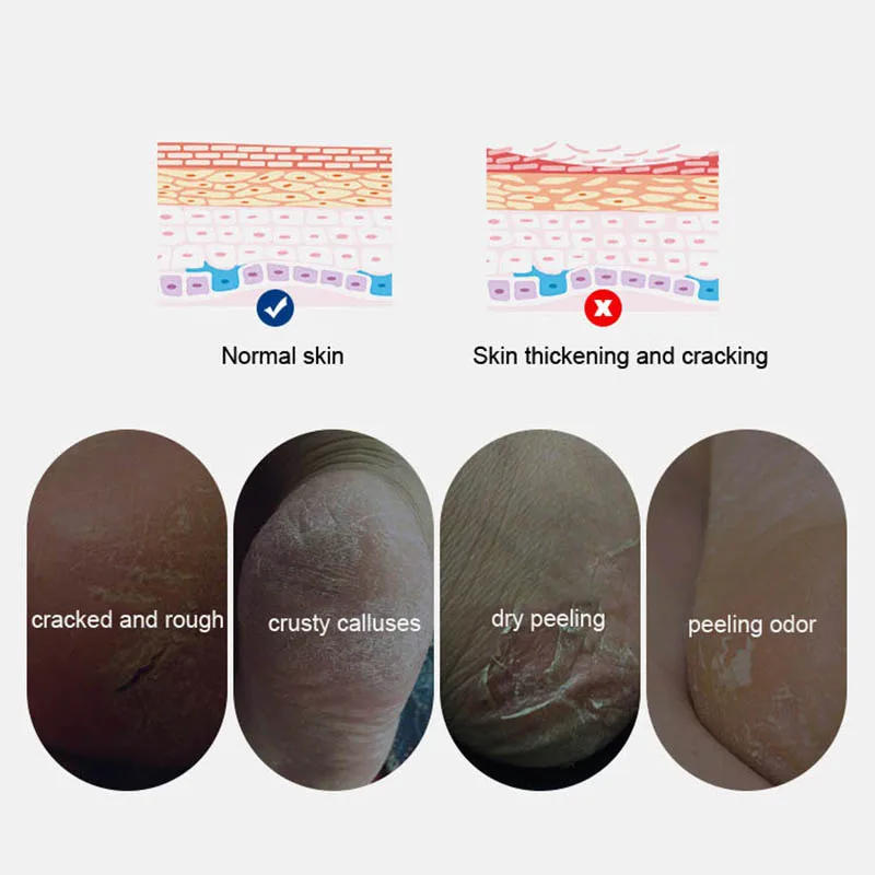 Description Picture 5 of itemSilicone Heel Protector Feet Care Skin Repair Cushion Half-yard Socks for Women Men Heel Cover Relief Heel Pain Reduce Pressure