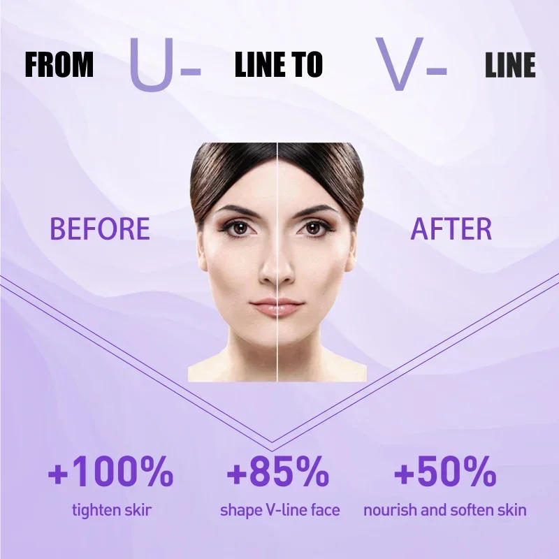 Description Picture 5 of itemFace-lift Slimming Cream Slimming Firming V-Shape Removal Masseter Muscle Double Chin Face Fat Burning Anti-aging Products 30g