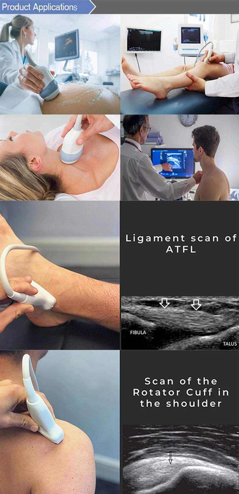 Description Picture 5 of itemCouplant Gel Professional Ultrasonic Medical Coupling Agent Fetal Heart Rate Pregnancy B-Ultrasound Fetal Doppler Tool Accessory