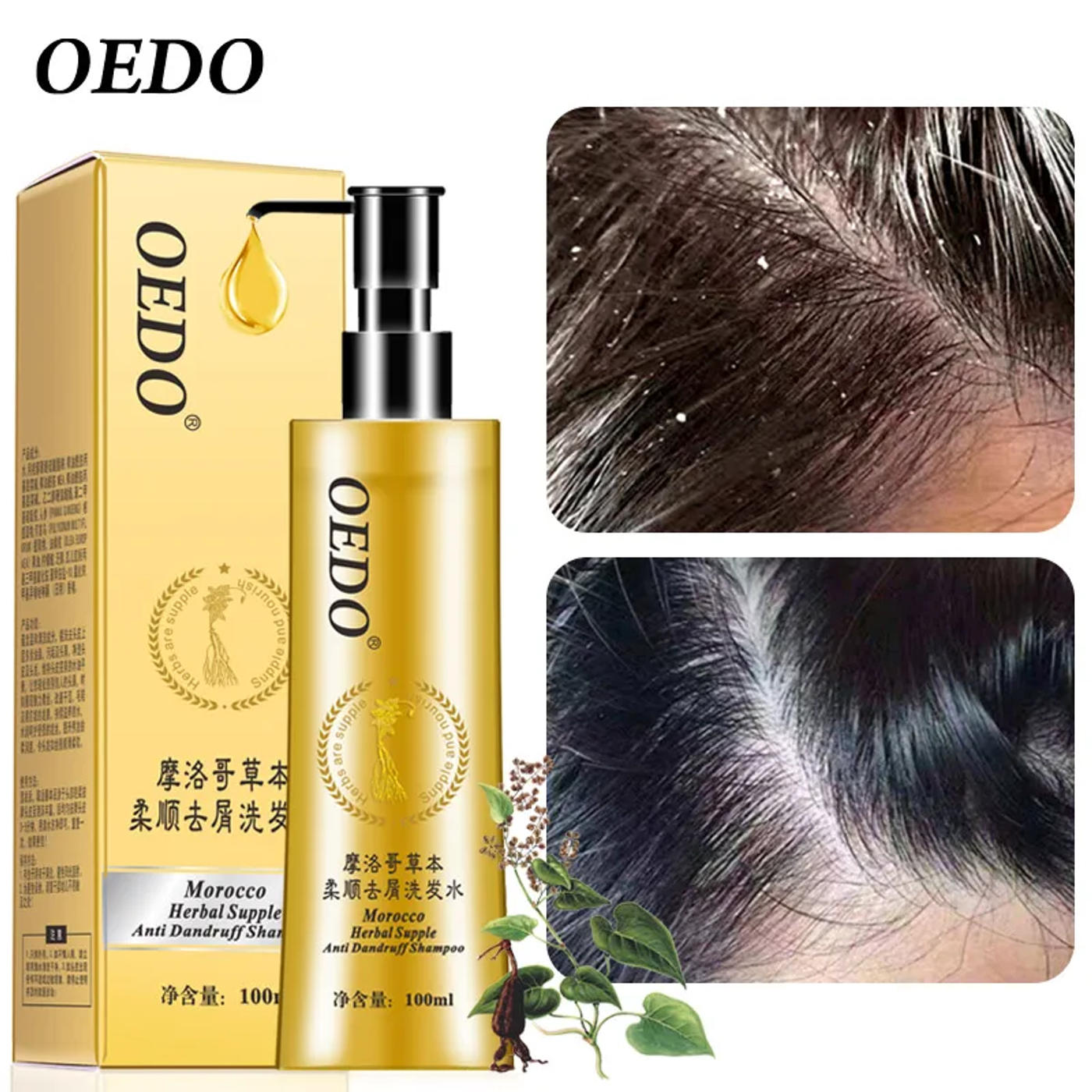 Slide 887d475ca32e4d5289047cc782048f10