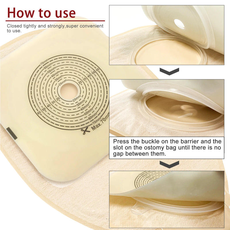 Description Picture 6 of item70mm 5Barriers/10Bags+5Barriers Ostomy Supplies Colostomy Bags Two Piece Drainable Pouches with hoop and look Stoma Care