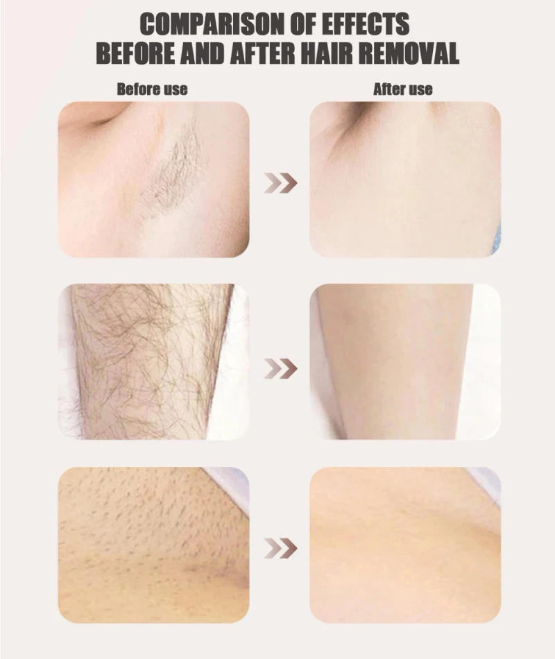 Description Picture 4 of itemElectric Shaver for Women Rechargeable Beard HairTrimmer Waterproof Razor Painless BodyClipper Shaving Face Groomer Hair Removal