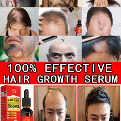 Plant essence hair growth spray products for men and women, ginger anti-hair loss, rapid regeneration, thickening, oil control,