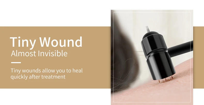 Description Picture 5 of itemTAIHE Acupuncture Needle Hammer Double Head Skin Seven Star Plum Blossom Hammer Sterile Acupuncture Head MASSAG NEEDL Cupping