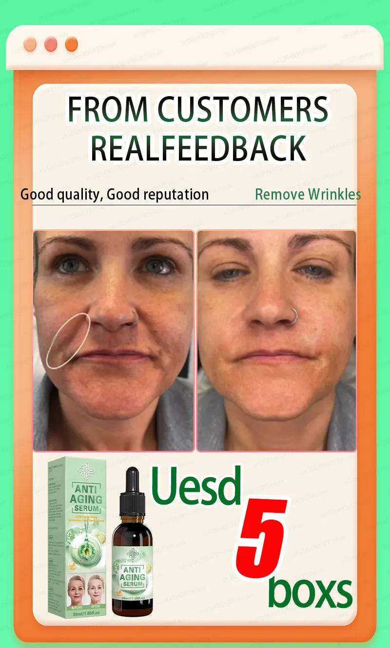 Description Picture 5 of itemWrinkles disappear, the first choice for beauty lovers