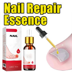 Foot Nail Essential Oil