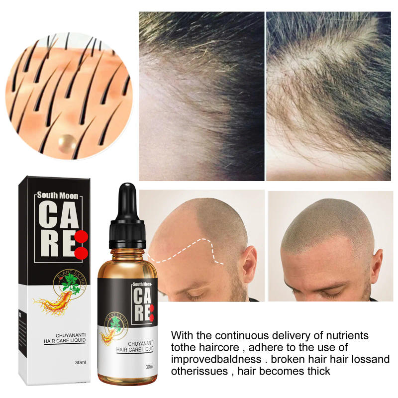 Description Picture 4 of itemAnti hair loss and hair growth liquid for hair growth, dense hair, and hair fixing herbal plant extract hair essence