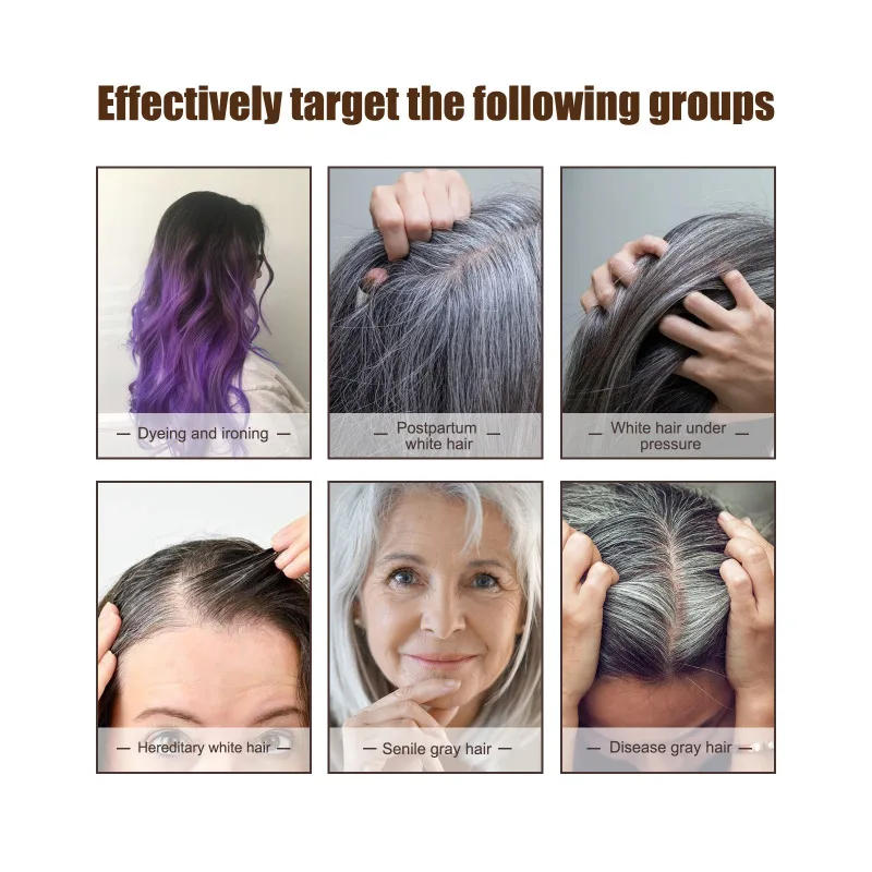 Description Picture 5 of itemAnti White Hair Serum Gray To Black Repair Damaged Scalp Nourish Hair Blacken Serum Reduce Gray Hair Darkening Growth Essence