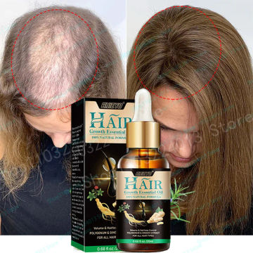 hair growth treatment Oil fast hair growth products  Anti Hair Loss Hair Scalp Treatment Serum Beauty Health