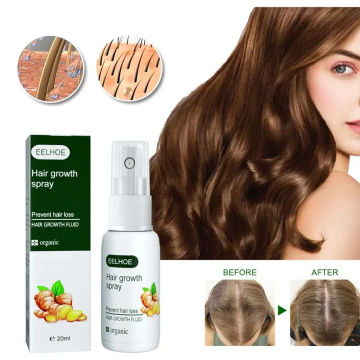Ginger Fast Anti Hair Loss Sprays Hair Growth Oil Hair Treatment Serum Nourish Scalp Regrowth Hairs Thinning Dry Repair Care
