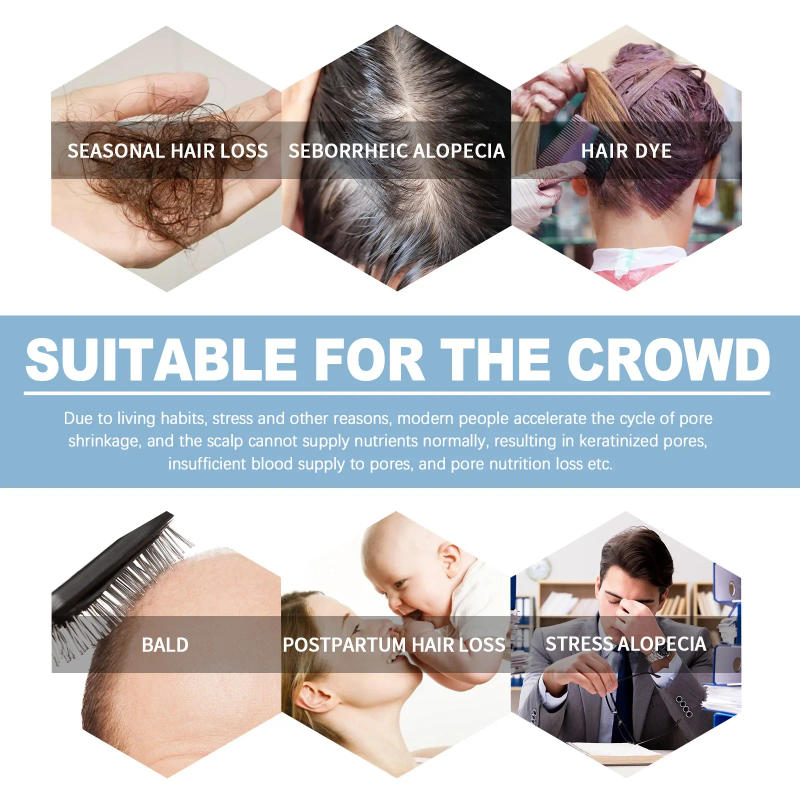 Description Picture 6 of itemSdotter Hair Growing Serum Prevent Hair Loss Thinning Scalp Massage Treatment Repair Tight Roots Nourishing Moisturize Hair Care