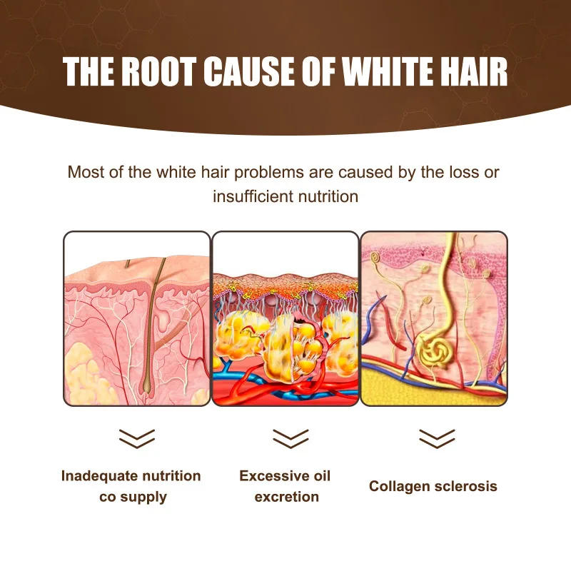 Description Picture 6 of itemAnti White Hair Serum Gray To Black Repair Damaged Scalp Nourish Hair Blacken Serum Reduce Gray Hair Darkening Growth Essence