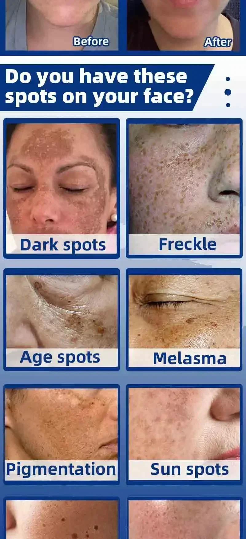 Description Picture 4 of itemPowerful Whitening Cream Skin Care Remove Freckle Melasma Dark Spots Corrector Lighten Melanin Pigmentation Brighten Product