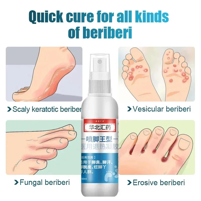 Description Picture 2 of itemFoot Deodorant Spray Remove Fungus Beriberi Treatment Anti-sweat Moisturize Skin Deodorant Anti Itch Feet Athletes Foot Liquid