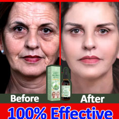 Wrinkles disappear, the first choice for beauty lovers