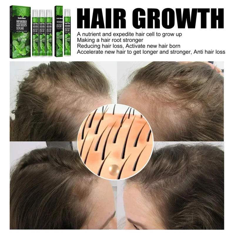 Description Picture 6 of itemFast Growing Hair Spray Herbal-Essence Hair Loss Care Spray Hair Growth Products For Beauty Hair & Scalp