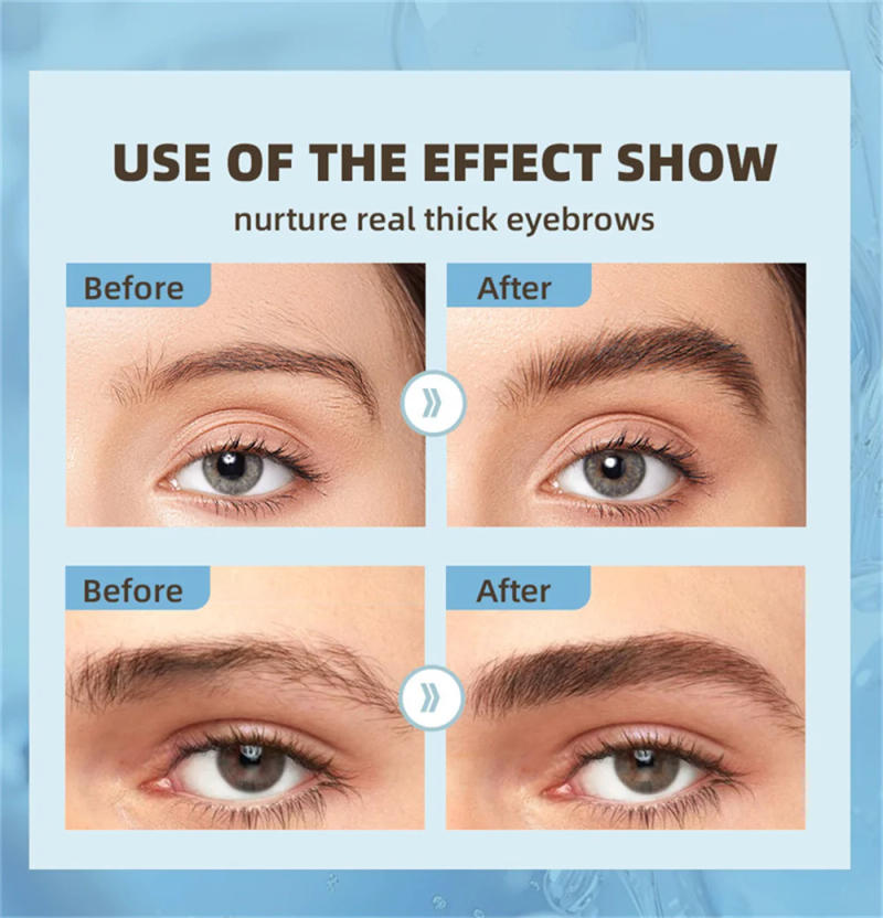 Description Picture 6 of itemEyebrow Eyelash Growth Serum Fast Growing Prevent Hair Loss Damaged Treatment Prevent Baldness Fuller Thicker Eye Care Makeup
