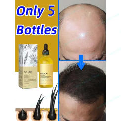 Fast hair growth promoter products Hair loss Hereditary Seborrheic alopecia treatment oil For Hair growth essence Natural safety