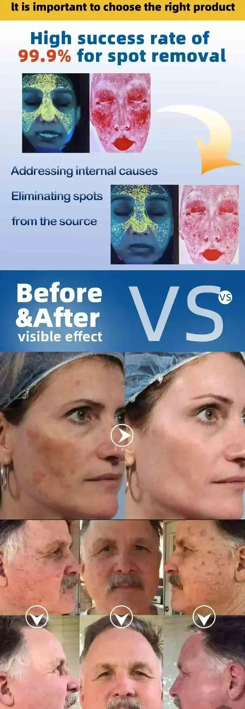 Description Picture 6 of itemPowerful Whitening Cream Skin Care Remove Freckle Melasma Dark Spots Corrector Lighten Melanin Pigmentation Brighten Product