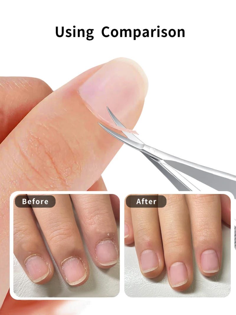 Description Picture 5 of itemRussian Dovetail Scissors Beauty Nail Nail Removal Dead Skin Nail Barbs Curved StainlessSteel Spring Dead Skin Scissors