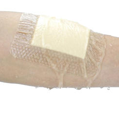 5Sizes Hydrocolloid Adhesive Dressing Wound Dressing Sterile Bedsore Healing Pad Patch Wound Care