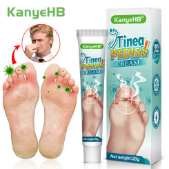 Foot Deodorant Cream Foot Odor Bacteriostasis Antipruritic Athlete's Foot Ointment Skin Topical Cream Personal Health Care