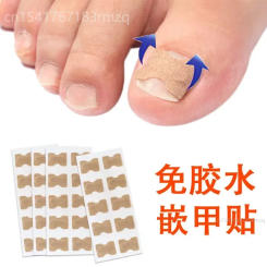 Nail Correction Stickers Ingrown Toenail Corrector Patches Treatment Recover Corrector Pedicure Care Tool foot massage 서큘레이터