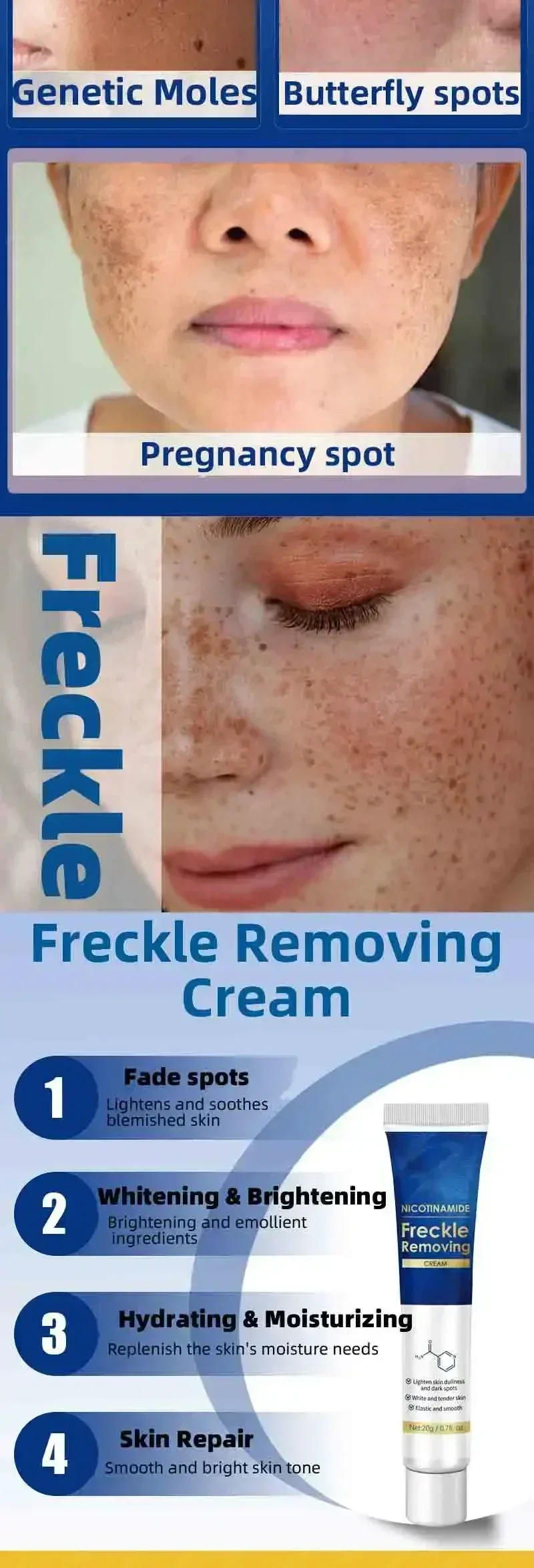 Description Picture 5 of itemPowerful Whitening Cream Skin Care Remove Freckle Melasma Dark Spots Corrector Lighten Melanin Pigmentation Brighten Product