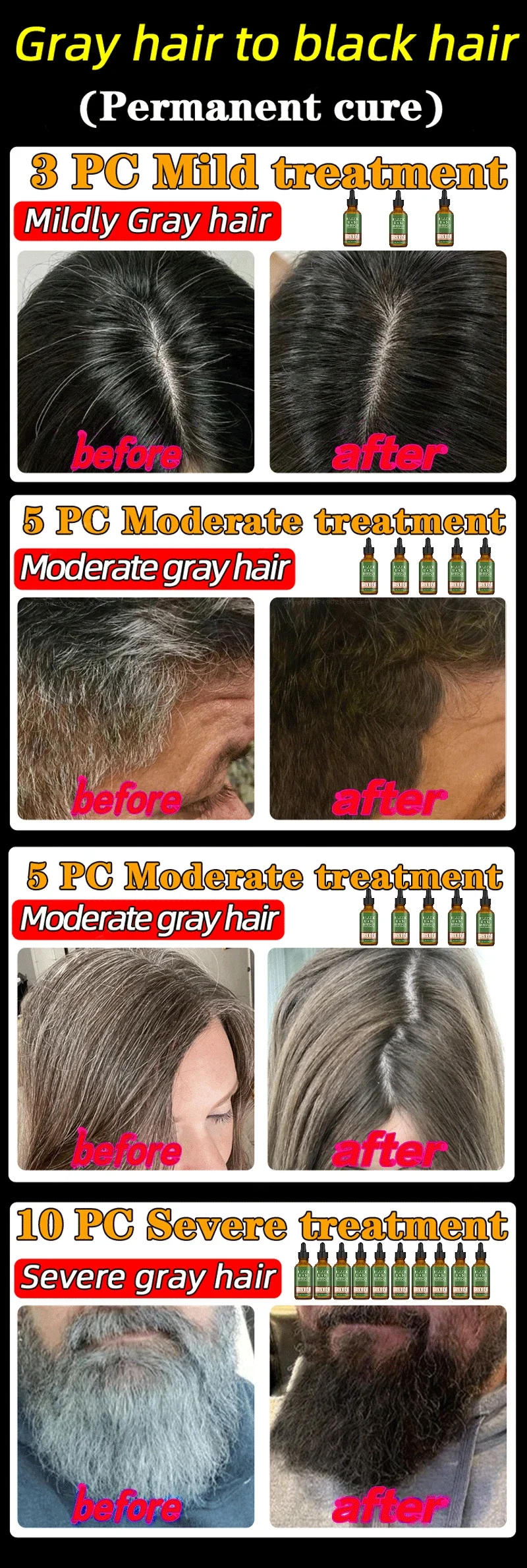 Description Picture 4 of itemGray Hair Treatment Serum White to Black Natural Color Repair Nourishing Products Anti-Hair Loss Care Men Women