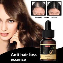 Hair Growth Oil Fast Hair Growth Effective Baldness Repair Hereditary Hair Loss Postpartum Hair Loss Seborrheic Hair Loss
