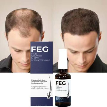 FEG Prevent Hair Lossand Stimulate Hair focile growth Hair Growth Spray 50ml