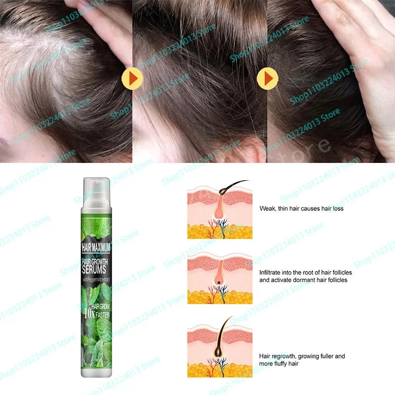Description Picture 6 of itemNatural Hair Growth Oil Efficient Anti Hair Loss Nourishing Essential Oil For Dense Repair Damaged Hair Moisturizing Smooth Oil